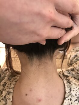 ナノハナ/鹿沼市本格全身脱毛ナノハナ