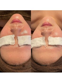 カシェット(cachette)/マグネットパック