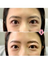 ノエルブラン(Noel blan)/毛流れ＆毛量統一で一気に垢抜け