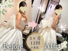 スリムプロ 天王寺店(Slimpro)/ブライダルエステ☆