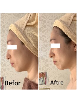 スペチアーレ 夙川/驚きの引き上がり