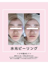 ソワナ(soina)/【神楽坂駅/フェイシャル/毛穴】