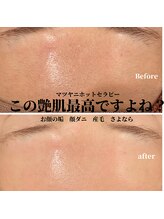 サロン ド リリー(salon de lily)/マツヤニホットセラピー