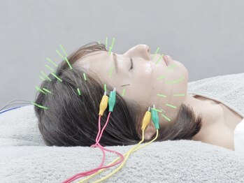 ハリカ 東京新宿店(HARIKA)の写真/【全国の花嫁様御用達！】ブライダルプランで挙式や前撮りまでにお顔のお悩みを解消し、小顔美人に♪