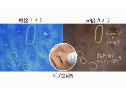 ステラ(Stella)の写真