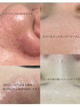 ヴィーナス(Venus)/フェイシャルWAX