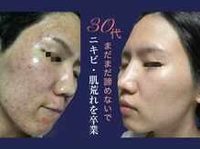 ナンバー19(N°19)