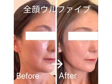 エステサロン ベルジュール/