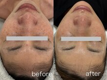 イーサロン(eii salon)/30代女性