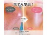 【リピートNo.1】毛穴エクストラクション+ハイドロ +炭酸パック¥13900