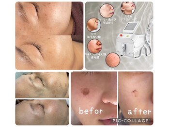 エスボーテ(sbeaute)の写真/肌本来の美しさを呼び覚ます、光フォト。