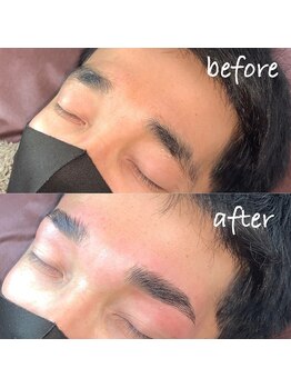 アンベリール(embellir)/ハリウッドブロウリフト(HBL)