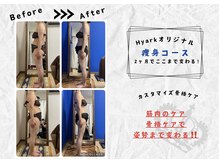 サロンデュ ひゃーく(Salon du ひゃーく)/痩身、骨格ケアするならこれ！