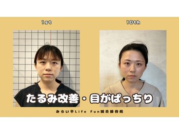 ライフファン鍼灸接骨院 みらい平(Life Fun鍼灸接骨院)/