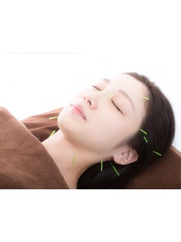 鍼灸施術を受けたい