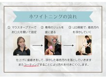 ホワイトニングショップ 尼崎店/ホワイトニング