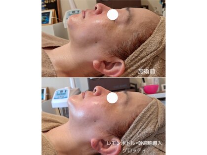 クッカ(kukka)の写真