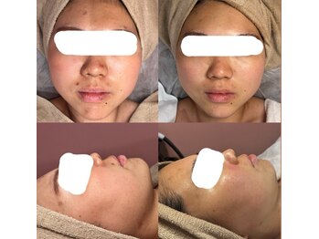 チュベルフェ(tu belle fe)/肌育徹底ケア