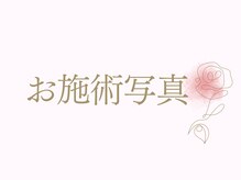 シア(Shia)/お施術写真