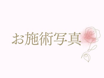 シア(Shia)/お施術写真