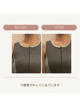 イロハナ(iro-hana)/ビフォーアフター