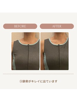 イロハナ(iro-hana)/ビフォーアフター