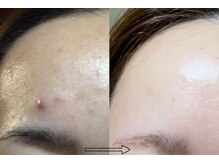 ララ オートクチュール(LALA HAUTOCOUTURE)の雰囲気（《肌質改善に強いサロン》国際資格を持ったスタッフ在籍）