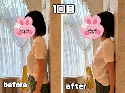 シャイン(Shine)の写真