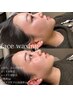 【全員/期間限定！】低刺激フルフェイスWAX(眉デザイン無）＋ハイドロ全顔
