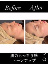 フーレスト アンド フリーリー(Fullest&Freely)/ララピールでトーンアップ