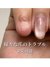 トラブル爪は専門店へお任せを