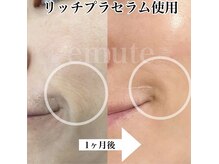 リュミエール デスポワール(Lumiere d'espoir)/ホームケア