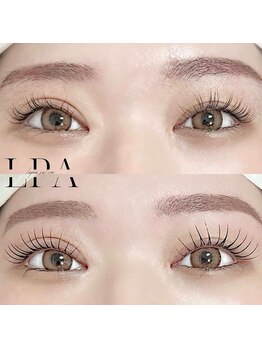 レピア 郡山駅前店/韓国式LEPIA Before&After