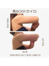 ビーシェイプ 君津(B-Shape)/【痩身】ビフォーアフター