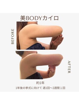 ビーシェイプ 君津(B-Shape)/【痩身】ビフォーアフター