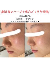 パールプラス 行橋店/ハーブ＋毛穴ごっそり洗浄
