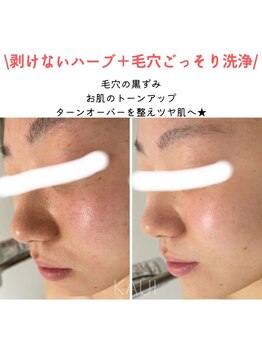 パールプラス 行橋店/ハーブ＋毛穴ごっそり洗浄