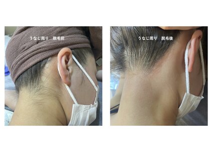 シーエステ(C.エステ)の写真
