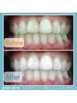 グロウ グロウ(grow.glow)/