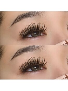 グラーティア バイ リブレイズ(Gratia by Liveraise)/バインドロック