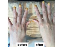 ロア ネイル アンド(loa nail and ...)の雰囲気（乾燥くすみに美容成分導入で年齢を感じないふっくらお手元へ）
