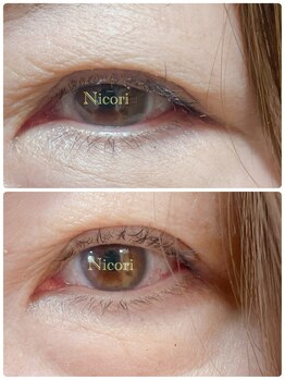 ニコリ(Nicori)/アイリッドアップパーマ