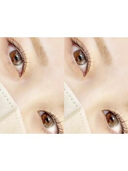 まつげのお悩み解決サロン
