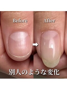 リリー/別人のように綺麗に