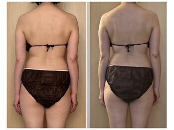 マイティー整骨院 ココア(CoCoa)/活性リンパ洗浄