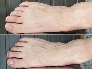 ハナワクシングプラス 高知(HanaWaxing+)/【台湾式足つぼ】