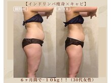 オキシー グレイス 黒崎店(OXY Grace)/インドリンパ痩身×キャビ