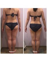 ナレル(narrel)/(新潟市/骨盤/痩身/ダイエット)