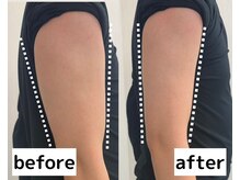 小顔専門店Lift(リフト)池袋東口/小顔専門店Lift｜Before After