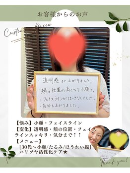 モーイエンチャーム(mooi en charme)/お客様のお声 (小顔・頬アップ)